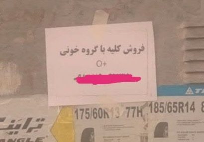 آگهی فروش کلیه در قم