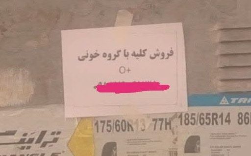 آگهی فروش کلیه در قم